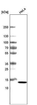 Western Blot: CT83 Antibody (CL4762) [NBP2-59062]