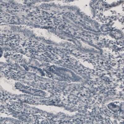 Immunohistochemistry-Paraffin: CT83 Antibody [NBP1-84343]