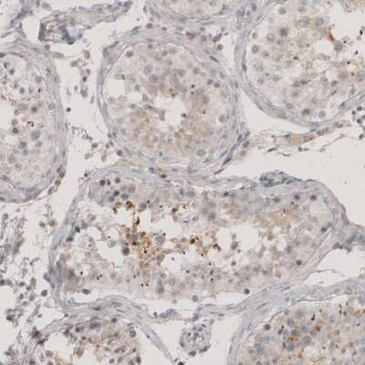 Immunohistochemistry-Paraffin: CT83 Antibody [NBP1-84343]