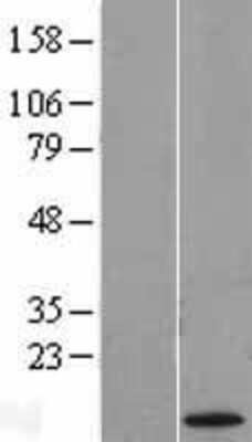 Western Blot: CT83 Overexpression Lysate [NBL1-09647]