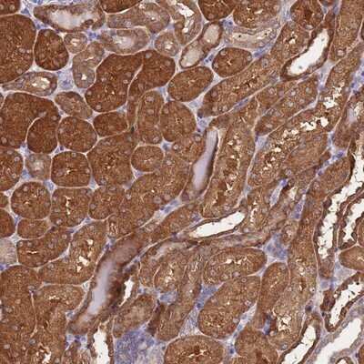 Immunohistochemistry-Paraffin: PRR32 Antibody [NBP2-14639]