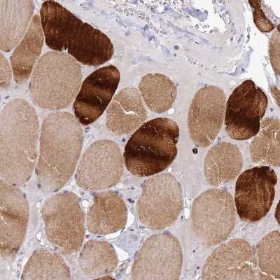 Immunohistochemistry-Paraffin: CXorf65 Antibody [NBP2-48871]