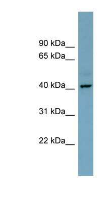 Western Blot: CXorf66 Antibody [NBP1-70511]