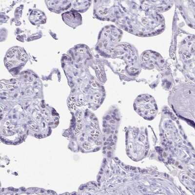 Immunohistochemistry-Paraffin: CXorf67 Antibody [NBP2-47498]