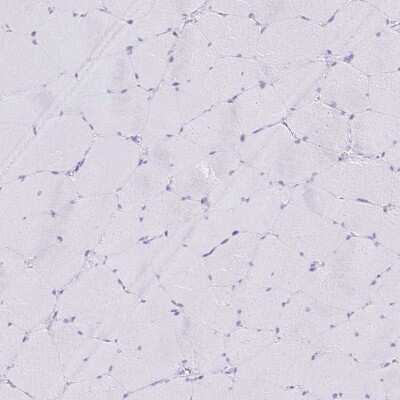 Immunohistochemistry-Paraffin: CXorf67 Antibody [NBP2-47498]