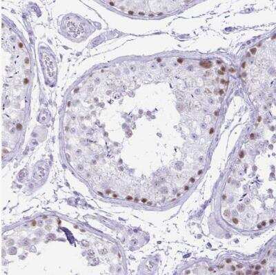 Immunohistochemistry-Paraffin: CXorf67 Antibody [NBP2-47498]