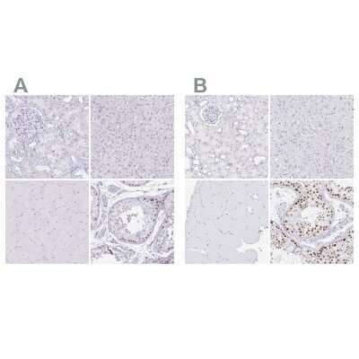 Immunohistochemistry-Paraffin: CXorf67 Antibody [NBP2-47498]