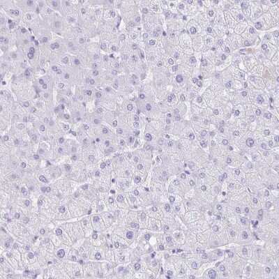 Immunohistochemistry-Paraffin: CXorf67 Antibody [NBP2-47498]