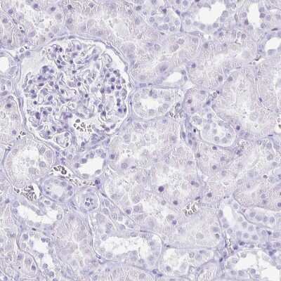 Immunohistochemistry-Paraffin: CXorf67 Antibody [NBP2-47498]