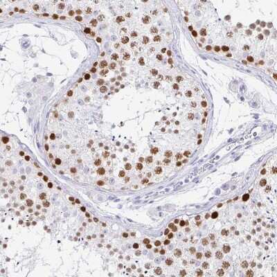 Immunohistochemistry-Paraffin: CXorf67 Antibody [NBP2-47499]