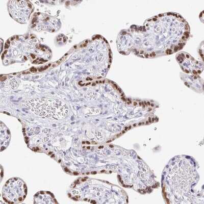 Immunohistochemistry-Paraffin: CXorf67 Antibody [NBP2-47499]