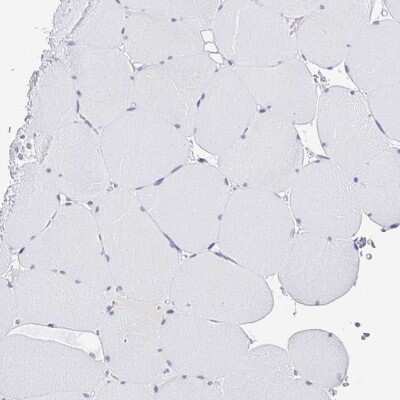 Immunohistochemistry-Paraffin: CXorf67 Antibody [NBP2-47499]