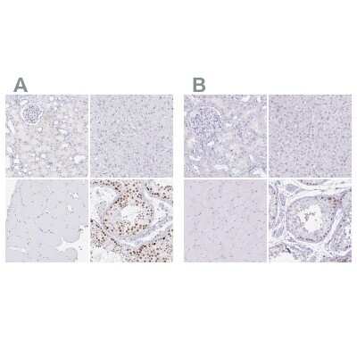 Immunohistochemistry-Paraffin: CXorf67 Antibody [NBP2-47499]