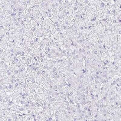 Immunohistochemistry-Paraffin: CXorf67 Antibody [NBP2-47499]