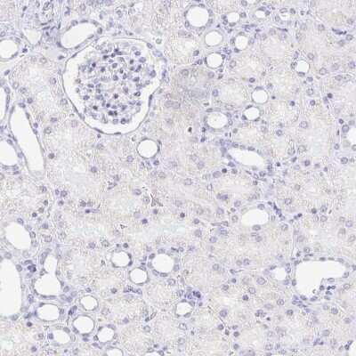 Immunohistochemistry-Paraffin: CXorf67 Antibody [NBP2-47499]