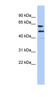 Western Blot: CXorf67 Antibody [NBP1-70512]