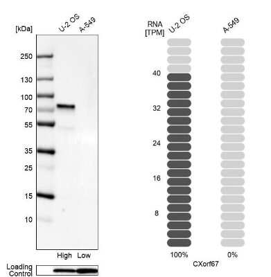 Western Blot: CXorf67 Antibody [NBP2-47498]