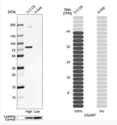 Western Blot: CXorf67 Antibody [NBP2-47499]