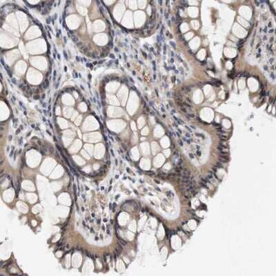 Immunohistochemistry-Paraffin: CYB561 Antibody [NBP1-83422]