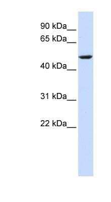 Western Blot: CYB561 Antibody [NBP1-60118]