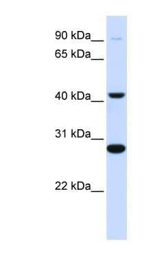 Western Blot: CYB561 Antibody [NBP1-62715]