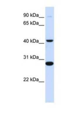 Western Blot: CYB561 Antibody [NBP1-69701]