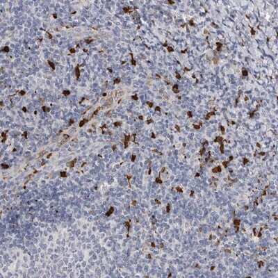 Immunohistochemistry-Paraffin: CYB561D1 Antibody [NBP1-83468]