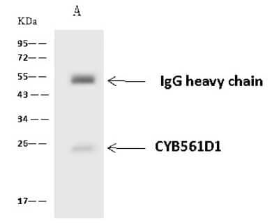 Immunoprecipitation: CYB561D1 Antibody [NBP2-98672]