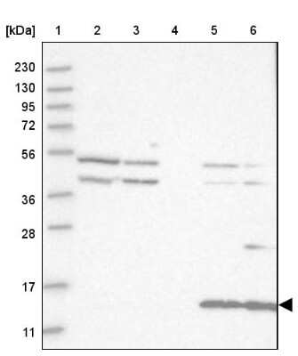 Western Blot: CYB561D1 Antibody [NBP1-83468]