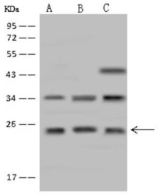 Western Blot: CYB561D1 Antibody [NBP2-98672]