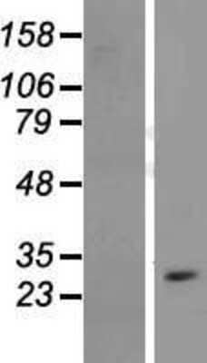 Western Blot: CYB561D1 Overexpression Lysate [NBL1-09649]