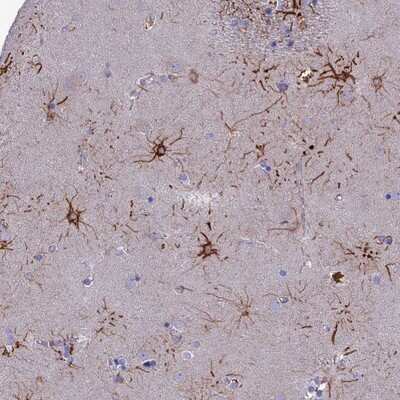 Immunohistochemistry-Paraffin: CYB561D2 Antibody [NBP1-89415]