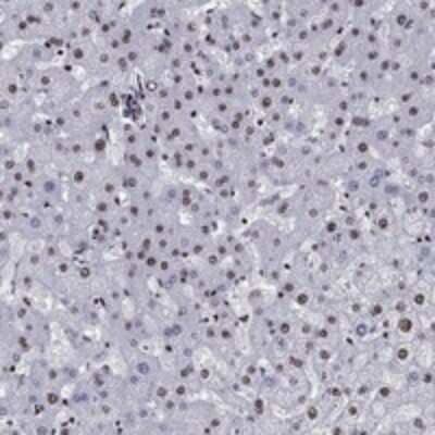 Immunohistochemistry-Paraffin: CYB561D2 Antibody [NBP3-17237]
