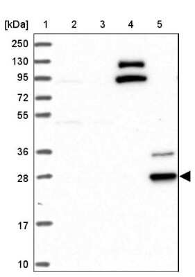 Western Blot: CYB561D2 Antibody [NBP1-89415]