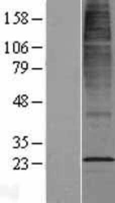 Western Blot: CYB561D2 Overexpression Lysate [NBL1-09650]