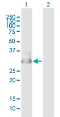 Western Blot: CYB5D1 Antibody [H00124637-B01P]