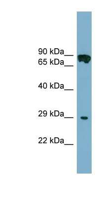 Western Blot: CYB5D1 Antibody [NBP1-56361]