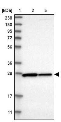 Western Blot: CYB5D1 Antibody [NBP1-83529]