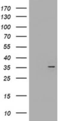 Western Blot: CYB5R1 Antibody (OTI2D10) [NBP2-45649]