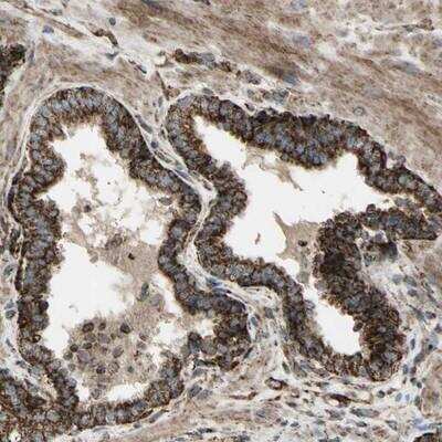Immunohistochemistry-Paraffin: CYB5R1 Antibody [NBP1-83145]