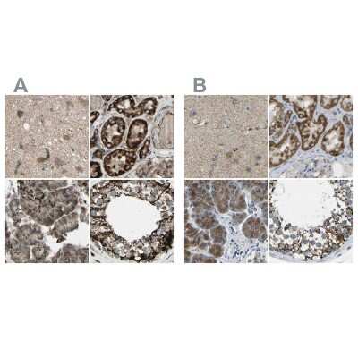 Immunohistochemistry-Paraffin: CYB5R1 Antibody [NBP1-83145]