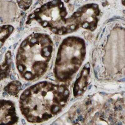 Immunohistochemistry-Paraffin: CYB5R1 Antibody [NBP1-83145]