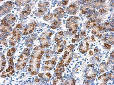 Immunohistochemistry-Paraffin: CYB5R1 Antibody [NBP2-16047]