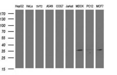 Western Blot: CYB5R1 Antibody (OTI2D10)Azide and BSA Free [NBP2-71946]
