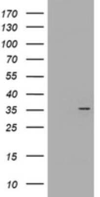 Western Blot: CYB5R1 Antibody (OTI2D10)Azide and BSA Free [NBP2-71946]