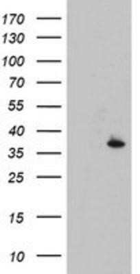 Western Blot: CYB5R1 Antibody (OTI4B7)Azide and BSA Free [NBP2-71943]