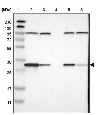 Western Blot: CYB5R1 Antibody [NBP1-83144]