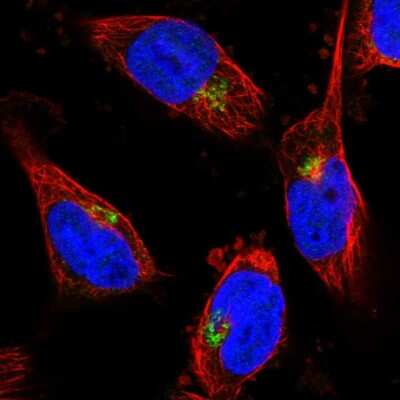 Immunocytochemistry/ Immunofluorescence: CYB5R2 Antibody [NBP1-85865]