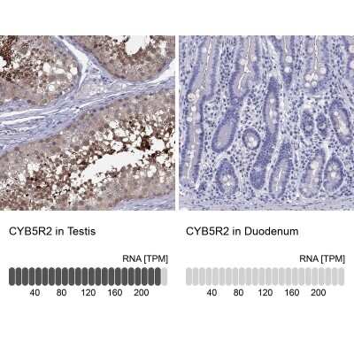 Immunohistochemistry-Paraffin: CYB5R2 Antibody [NBP2-62636]