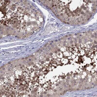 Immunohistochemistry-Paraffin: CYB5R2 Antibody [NBP2-62636]